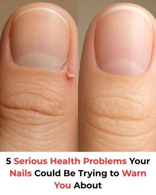 Five Dangerous Health Issues Your Nails May Be Trying to Alert You To